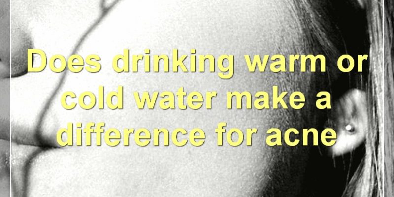 The Benefits Of Drinking Water For Acne