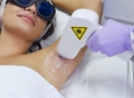 How Does Laser Hair Removal Work?