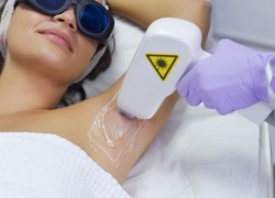 How Does Laser Hair Removal Work?