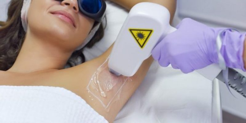 How Does Laser Hair Removal Work?