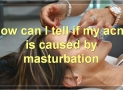 Masturbation And Acne: Everything You Need To Know
