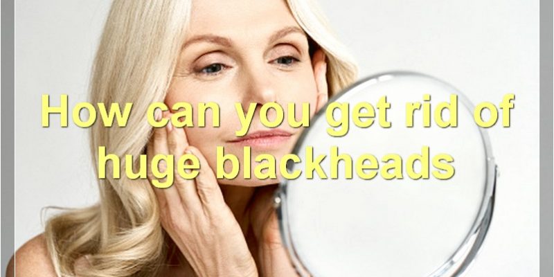 How To Get Rid Of Huge Blackheads