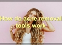 The Best Acne Removal Tools: How They Work And What To Know