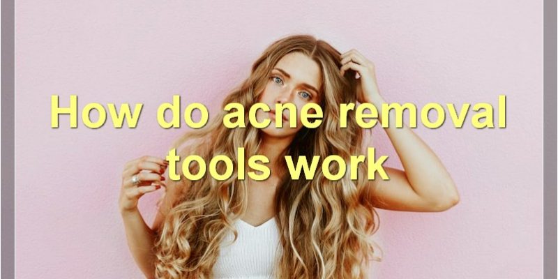 The Best Acne Removal Tools: How They Work And What To Know