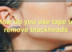 How To Remove Blackheads With Tape: The Complete Guide