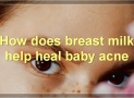 The Benefits Of Breast Milk For Baby Acne
