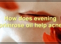 Evening Primrose Oil For Acne: Benefits, How To Use, Side Effects, And More