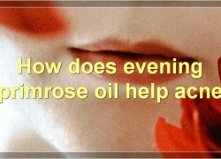 Evening Primrose Oil For Acne: Benefits, How To Use, Side Effects, And More