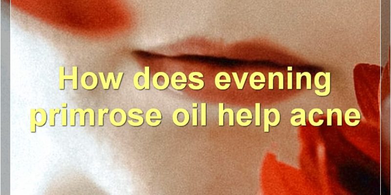 Evening Primrose Oil For Acne: Benefits, How To Use, Side Effects, And More