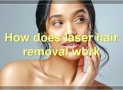 Laser Hair Removal: Everything You Need To Know