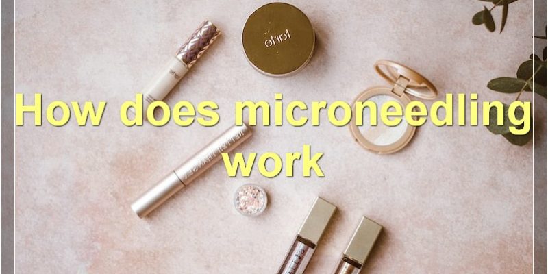 Microneedling: Everything You Need To Know