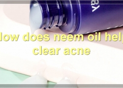Neem Oil For Acne: Benefits, How To Use, Side Effects, And More