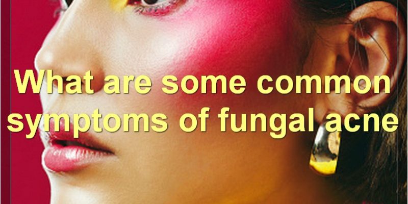 Fungal Acne: Causes, Symptoms, Treatments, And More