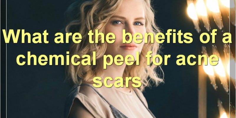 Chemical Peel For Acne Scars: Everything You Need To Know