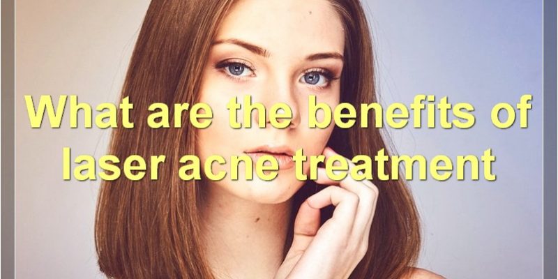 Laser Acne Treatment: Everything You Need To Know