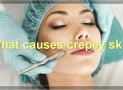 9 Treatments, Causes & Tips For Dealing With Crepey Skin