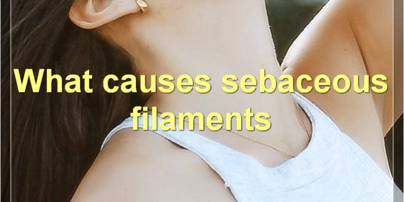 Sebaceous Filaments: Everything You Need To Know