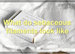 Everything You Need To Know About Sebaceous Filaments